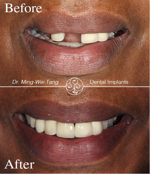 Award Winning Dental Clinics In Hammersmith, London