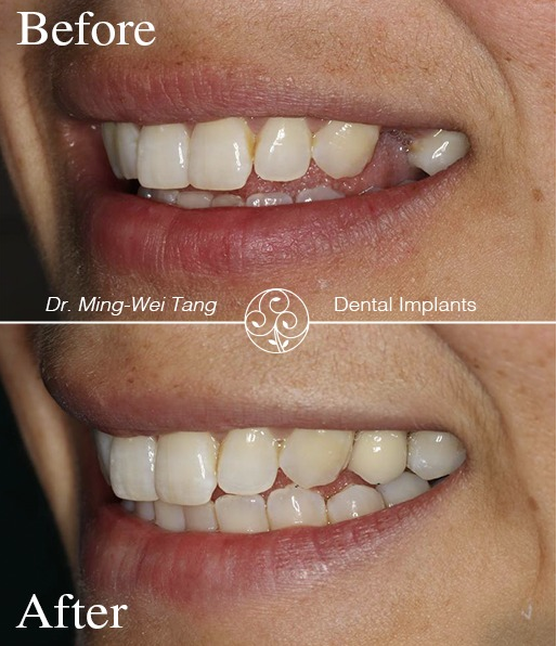 Award Winning Dental Clinics In Hammersmith, London